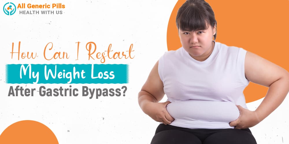 How Can I Restart my Weight Loss after Gastric By Pass?